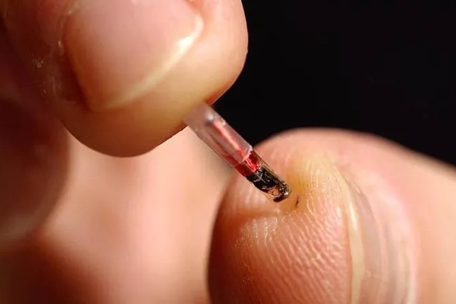 El controvertido “Chip de la Belleza”: la tecnología detrás del secreto de algunas celebridades
