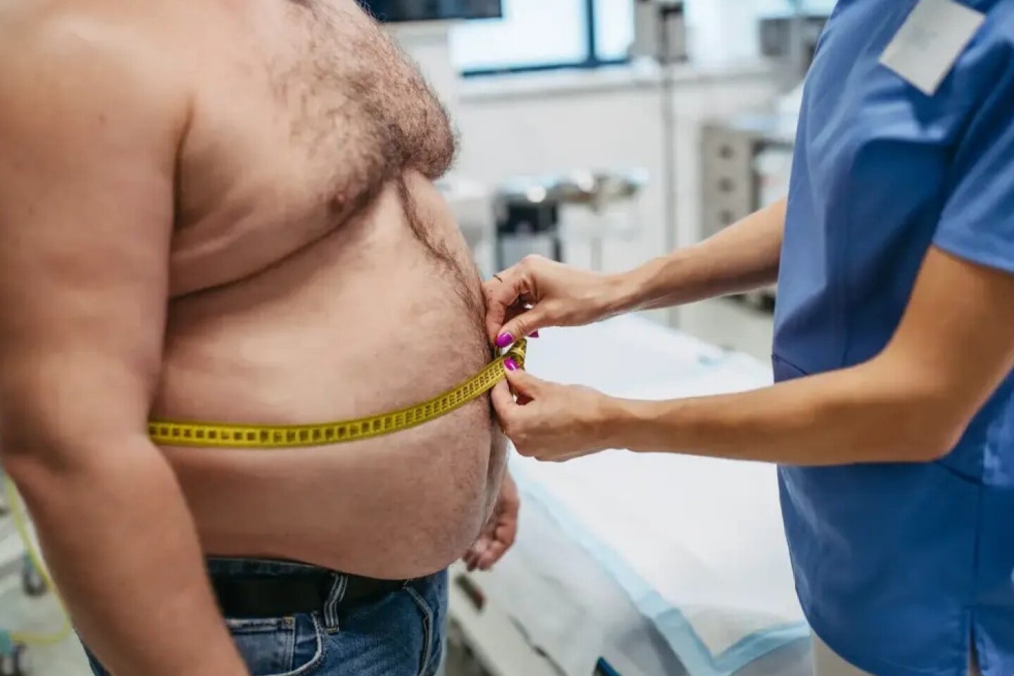 Día Mundial de la Obesidad: más del 34% de la población chilena sufre de obesidad 